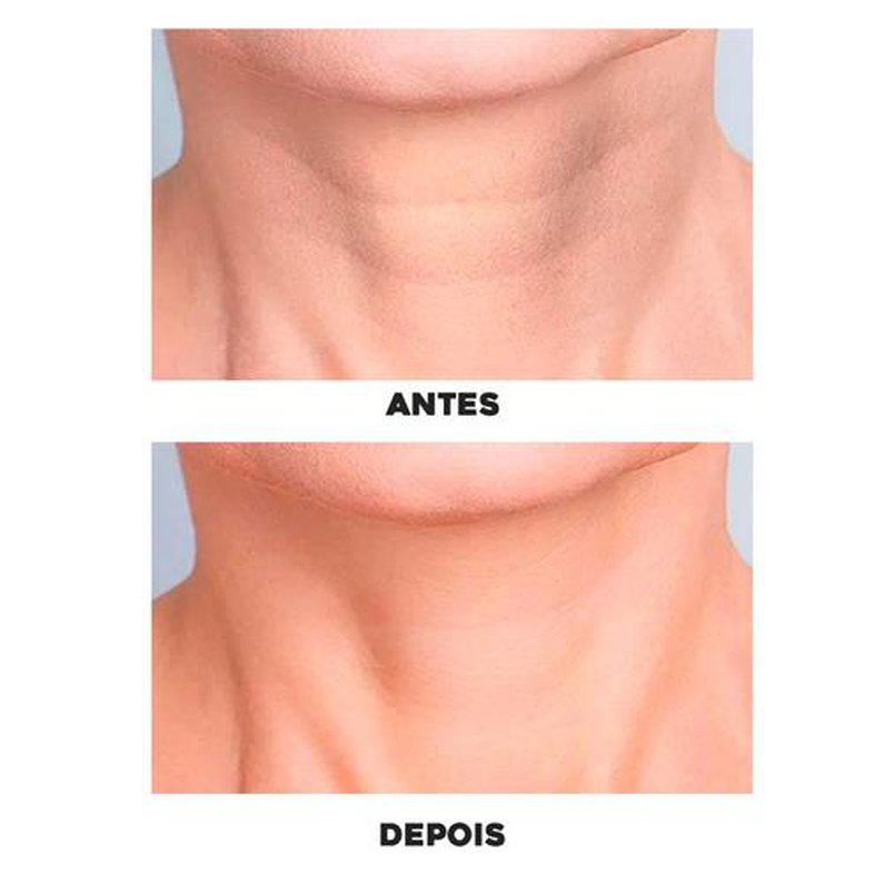 ADESIVOS ANTI SINAIS REUTILIZÁVEIS | SILICONE PADS + BRINDE EXCLUSIVO